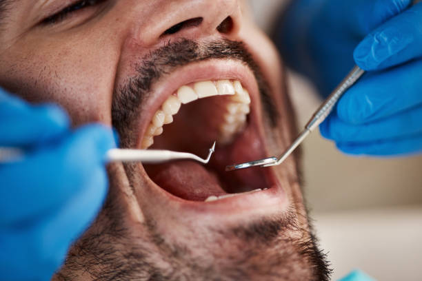 Best Orthodontic Emergency Dentist in Ttapoisett Center, MA